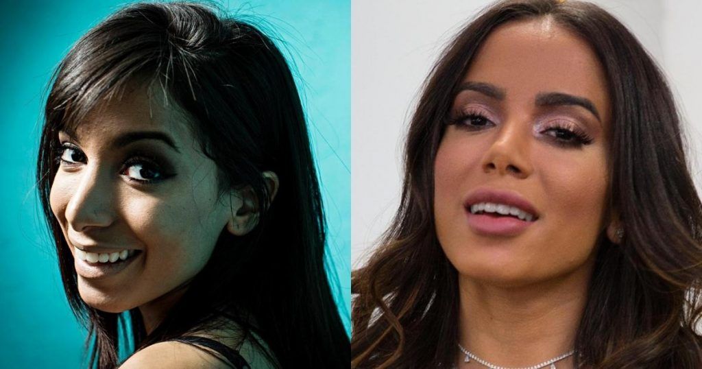 Anitta antes e depois da cirurgia plástica. 